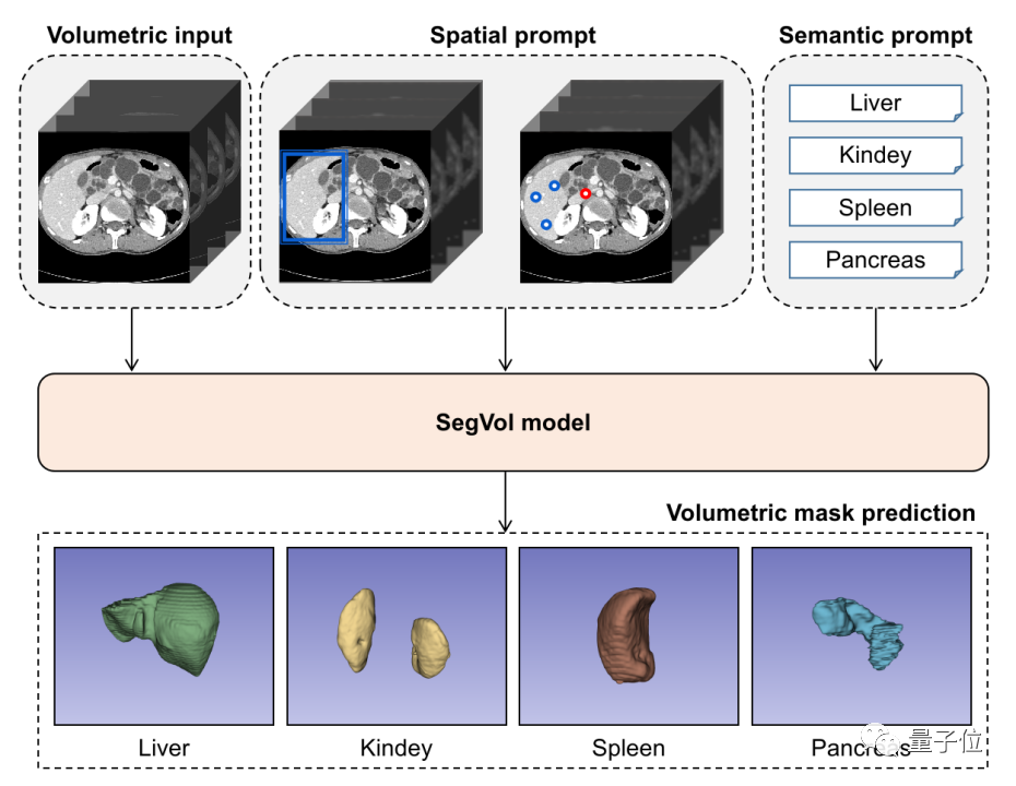 医学通用分割模型来了！一口气分割200多个解剖类别，发布即开源 | 智源出品