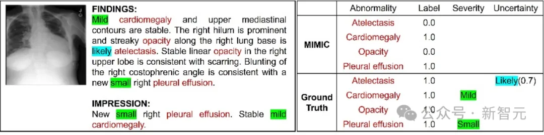3类严重程度，6级不确定性！德州大学等首创全新胸部X光数据集，登IEEE TMI