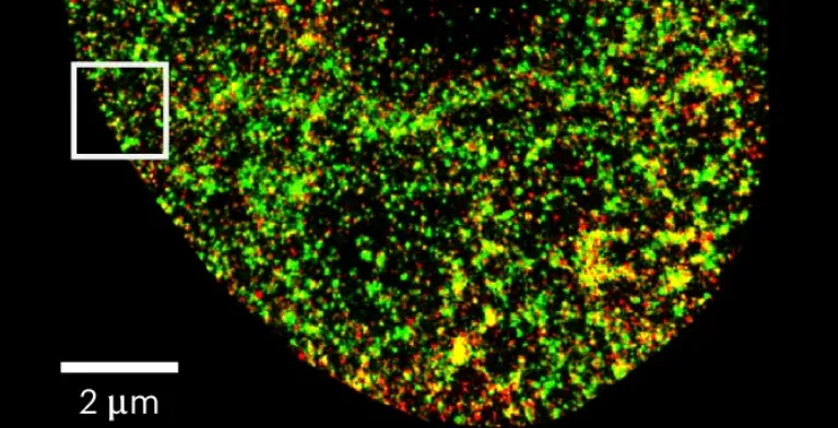 纳米级精度，病毒感染1h内即可检测到，南方医科大学细胞核AI工具登Nature子刊